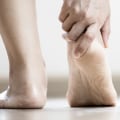 Supination vs Pronation of Foot: Expert Tips on Correcting Improper Foot Motion