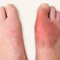 Expert's Guide to Common Foot Problems: Understanding Symptoms and Treatment Options