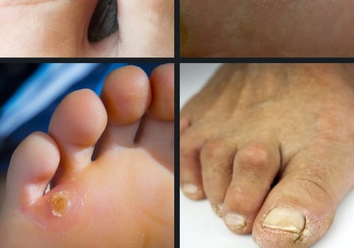 Expert Insights: Understanding and Treating Common Foot Disorders
