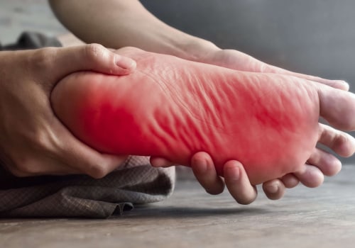 Expert Insights: The Causes and Treatment of Severe Foot Pain