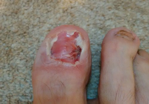 The Most Common and Serious Foot Injuries: An Expert's Guide